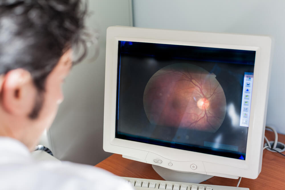doctor reviewing retina scan on computer